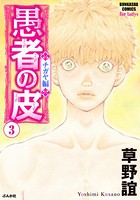 愚者の皮