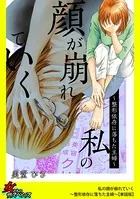 私の顔が崩れていく〜整形依存に落ちた主婦〜（単話）