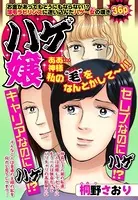 ハゲ嬢（単話）