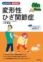 変形性ひざ関節症