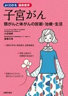 子宮がん 頸がんと体がんの診断・治療・生活
