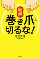 図解 巻き爪は切るな！