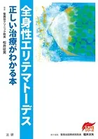 全身性エリテマトーデス 正しい治療がわかる本