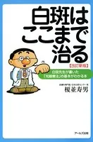 白斑はここまで治る